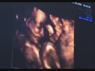 Echographie de la petite princesse