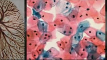 Wichita Falls, TX Mesothelioma Lawyer