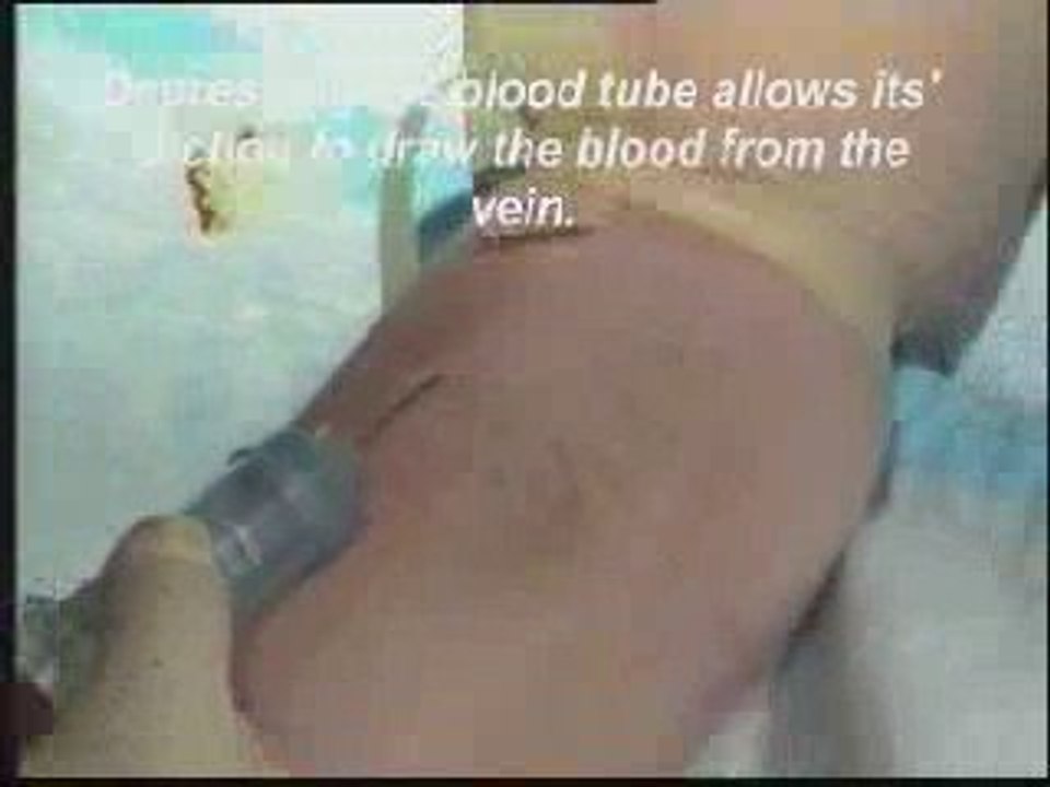 Blood Draw