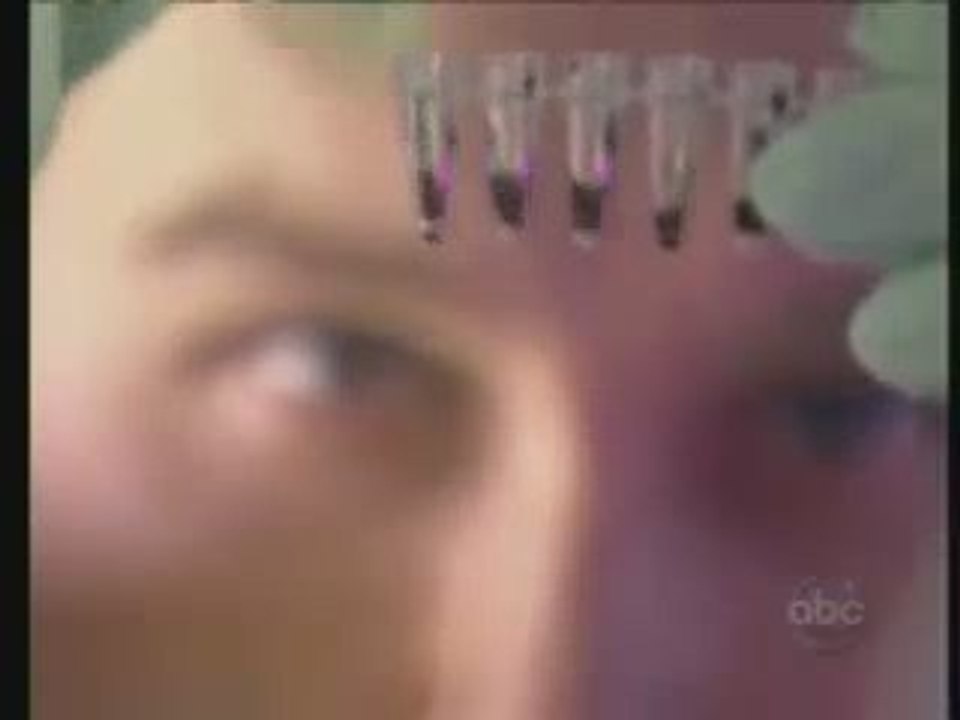 Resveratrol antiaging supplements