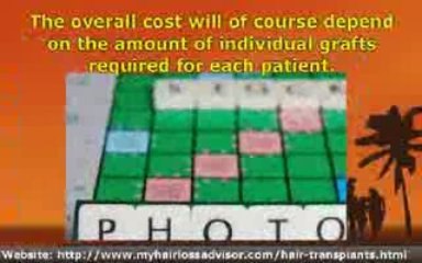 Assessing the Cost of a Hair Transplant