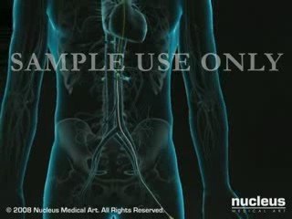 Coronary Artery Angiography &