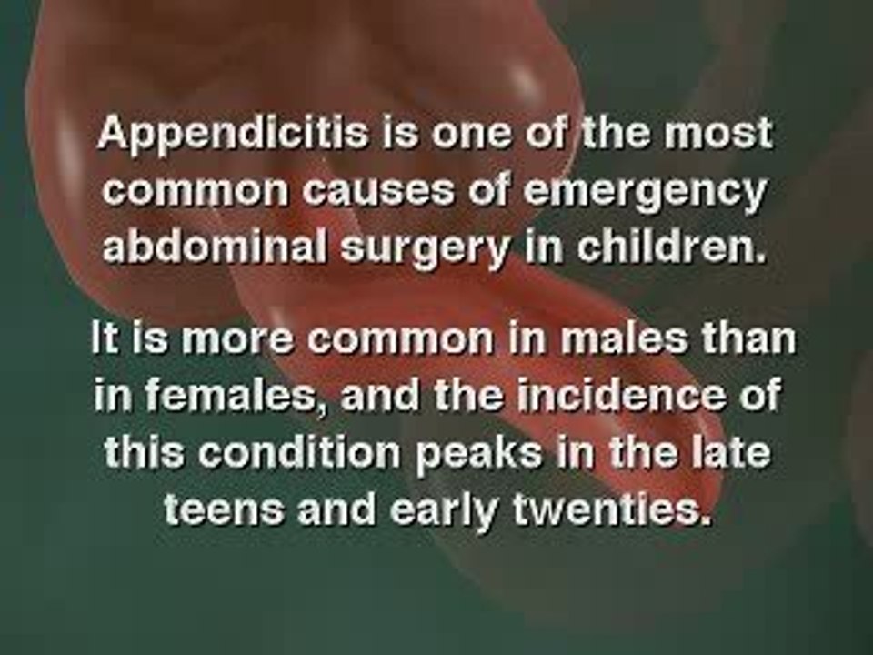 Appendicitis