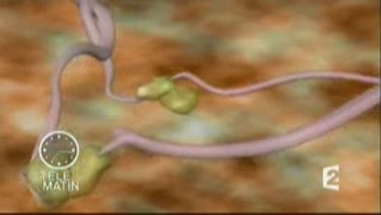 France2_Télématin_Alzheimer et création_20090917