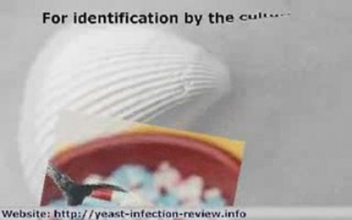 Candida Yeast Infection Symptoms and Treatment