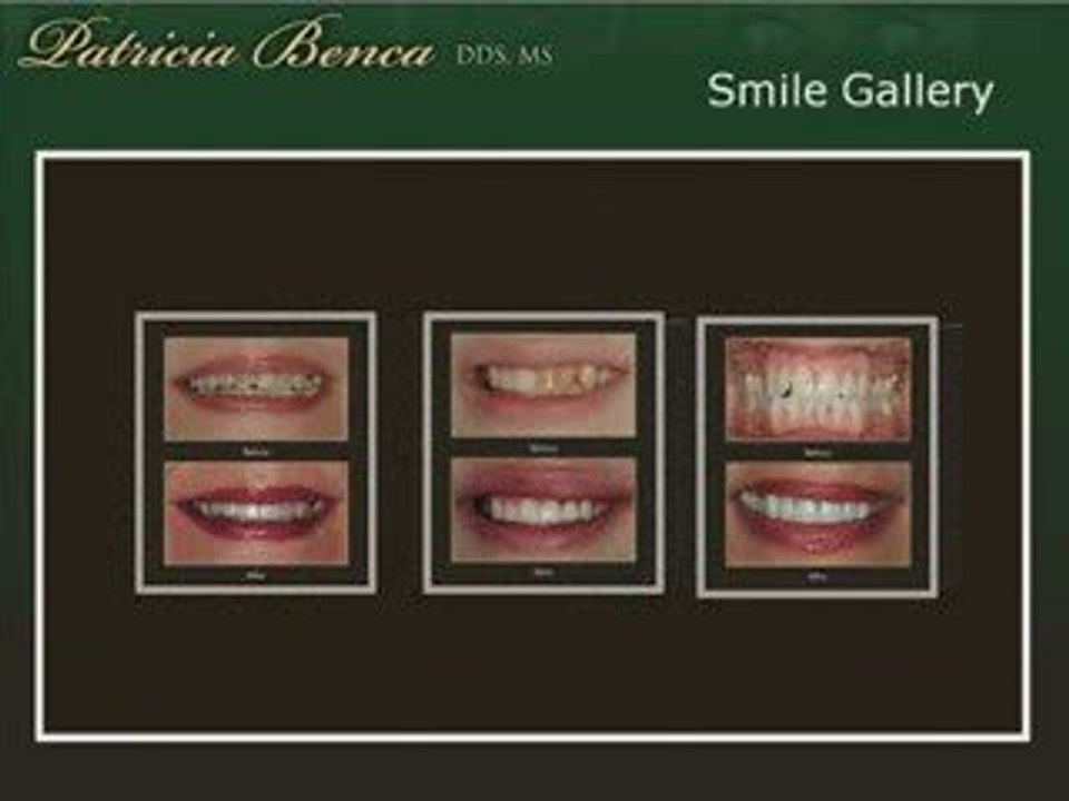 Seattle Washington Cosmetic Dentist Dr. Patricia Benca, ...