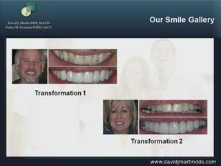 Cosmetic Dentistry by Totowa NJ Dentist Dr. David J. ...