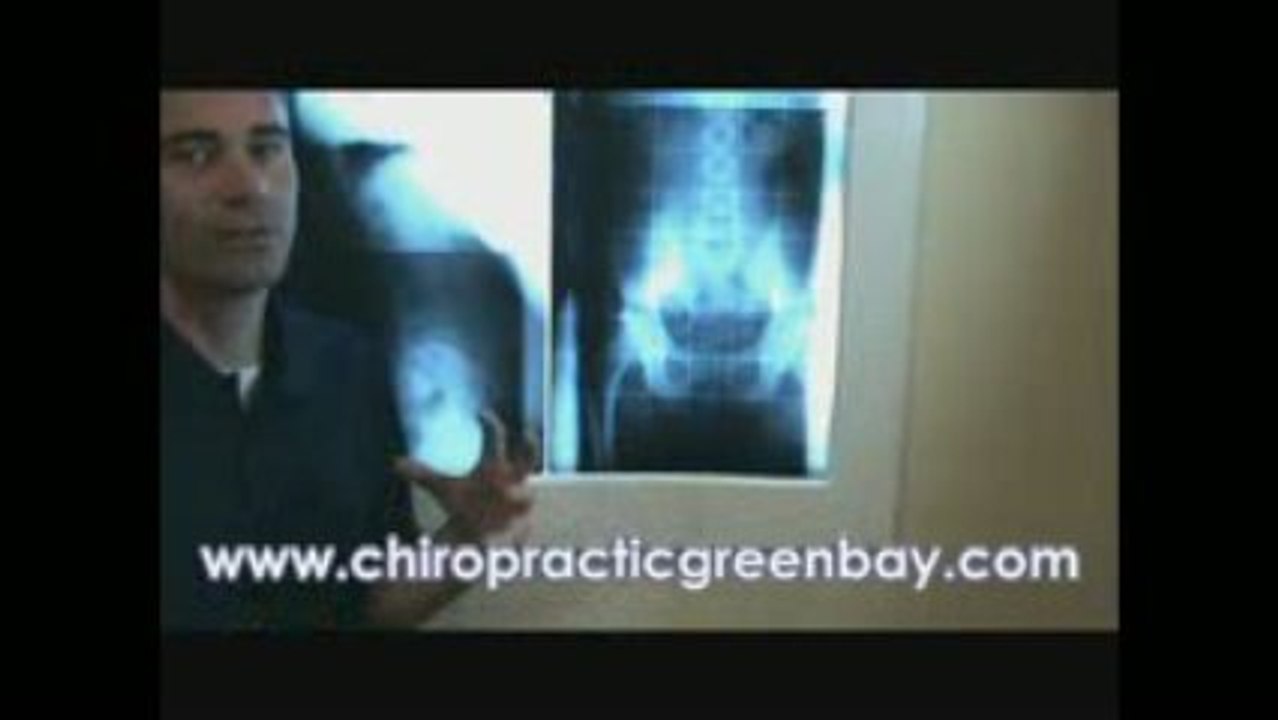 Back Pain Chiropractor Green Bay WI