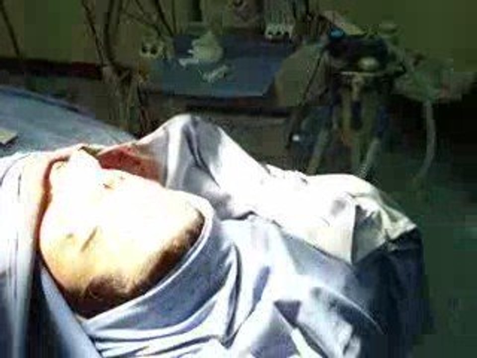 عملية تجميل الانف-جراحة تجميل الانف-المنخار-RHINOPLASTY-DUBA