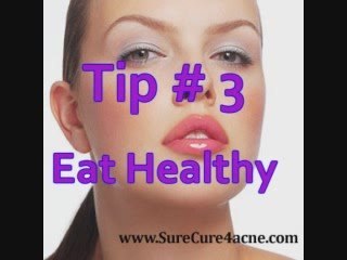 3-TIPS ON HOW TO STOP ACNE OUTBREAKS