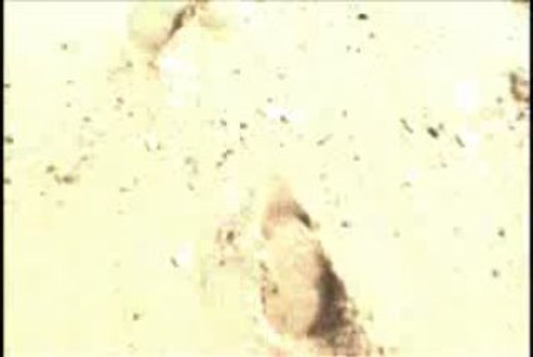 Overbounds - Black thinking