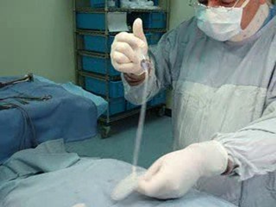 BREAST IMPLANTS-QATAR-DUBAI-تكبير الثدي-شد البزاز-تجميل صدر