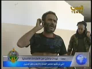 شهادات على السن ضحايا عناصر الارهاب الحوثية 1