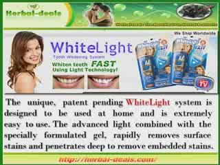 WHITELIGHT TEETH WHITENING SYSTEM REVIEW