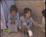 الحوثيون الارهابيون يقنصون طفلاً صغيراً ويكسروا ساقه  2