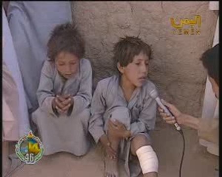 الحوثيون الارهابيون يقنصون طفلاً صغيراً ويكسروا ساقه 2