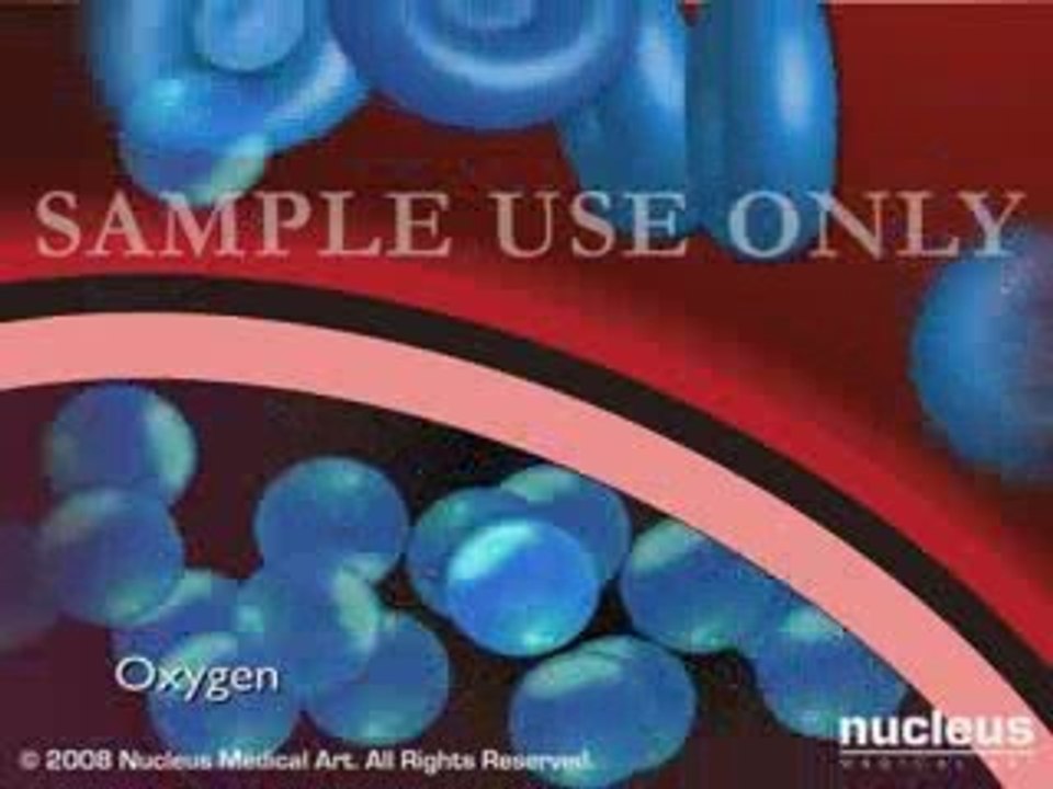 Lung Oxygenation