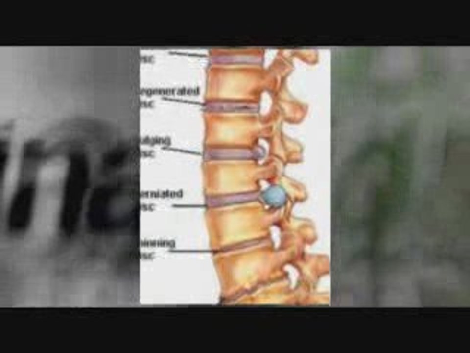 Reno Chiropractor alleviates Reno Back Pains