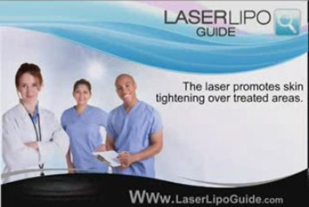 Laser Lipo # 1
