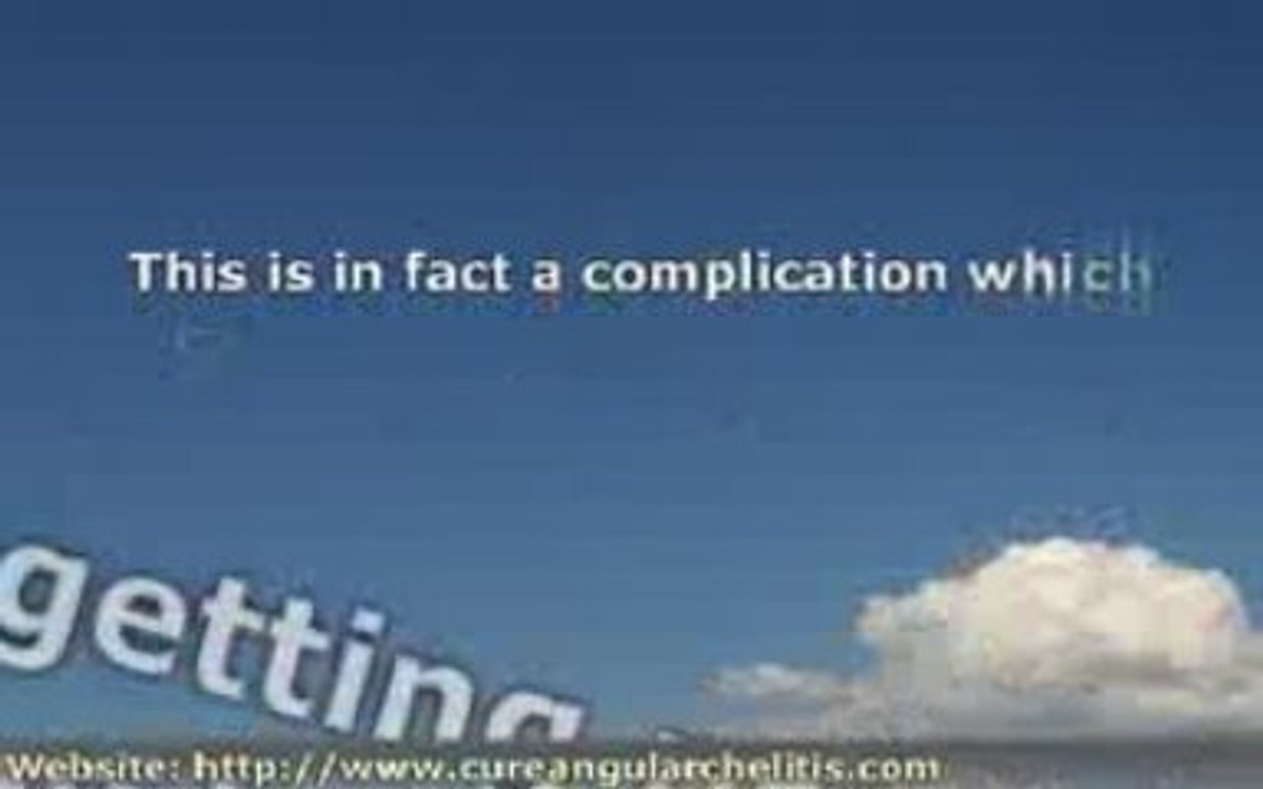 Angular Cheilitis: Causes and Effective Treatment Tips