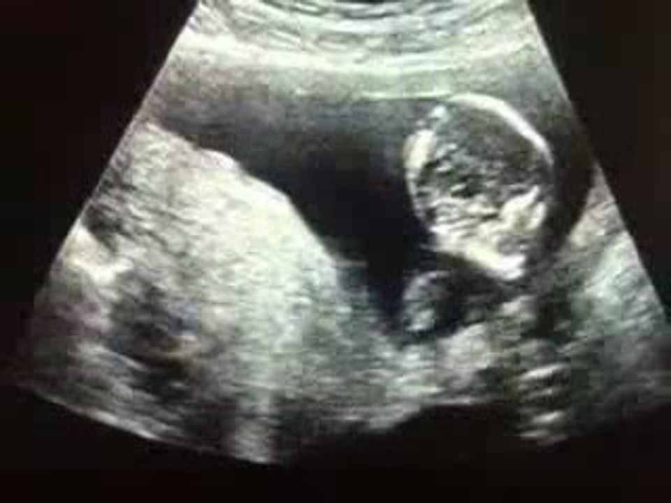 video de ma grossesse 1