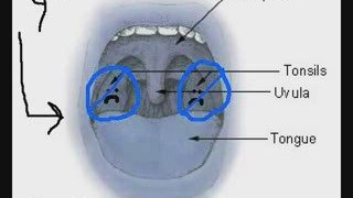 Annoying Cough, Sore Throat Feeling And Bad Breath