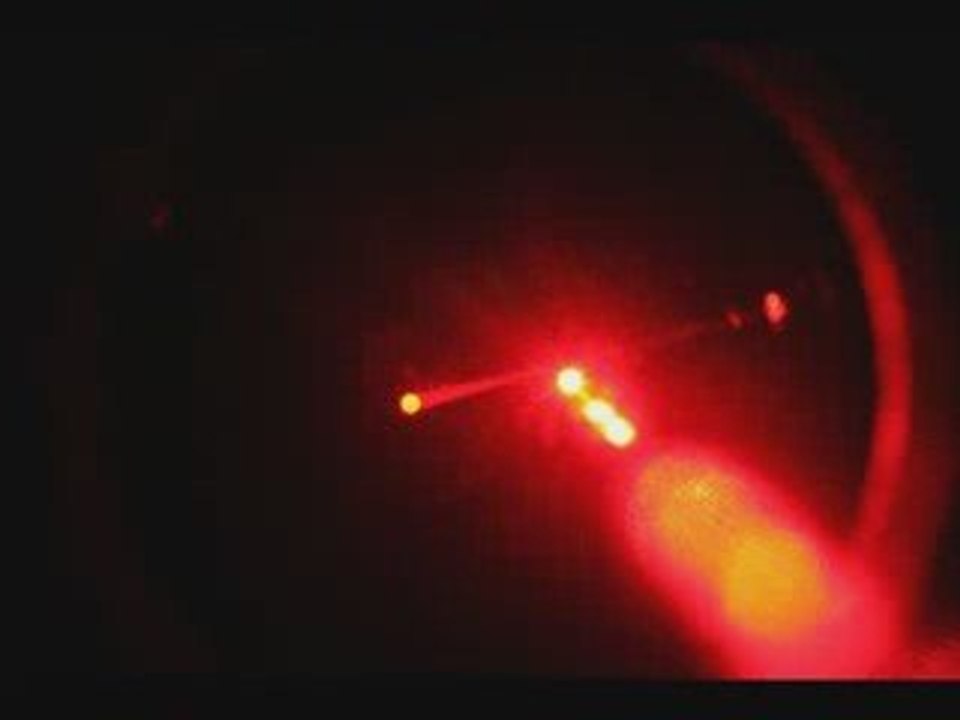 laser game Montivilliers