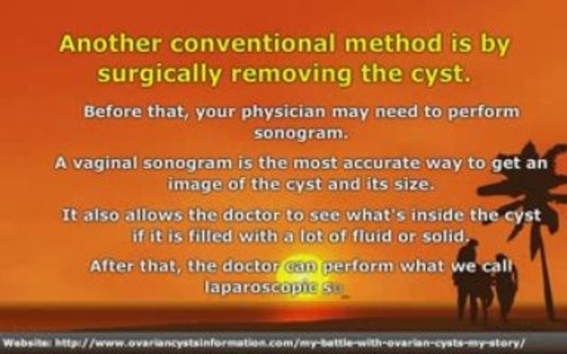 How to Treat Ovarian Cyst