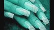 Adult Nail Biting - Ways to Quit Biting my Nails