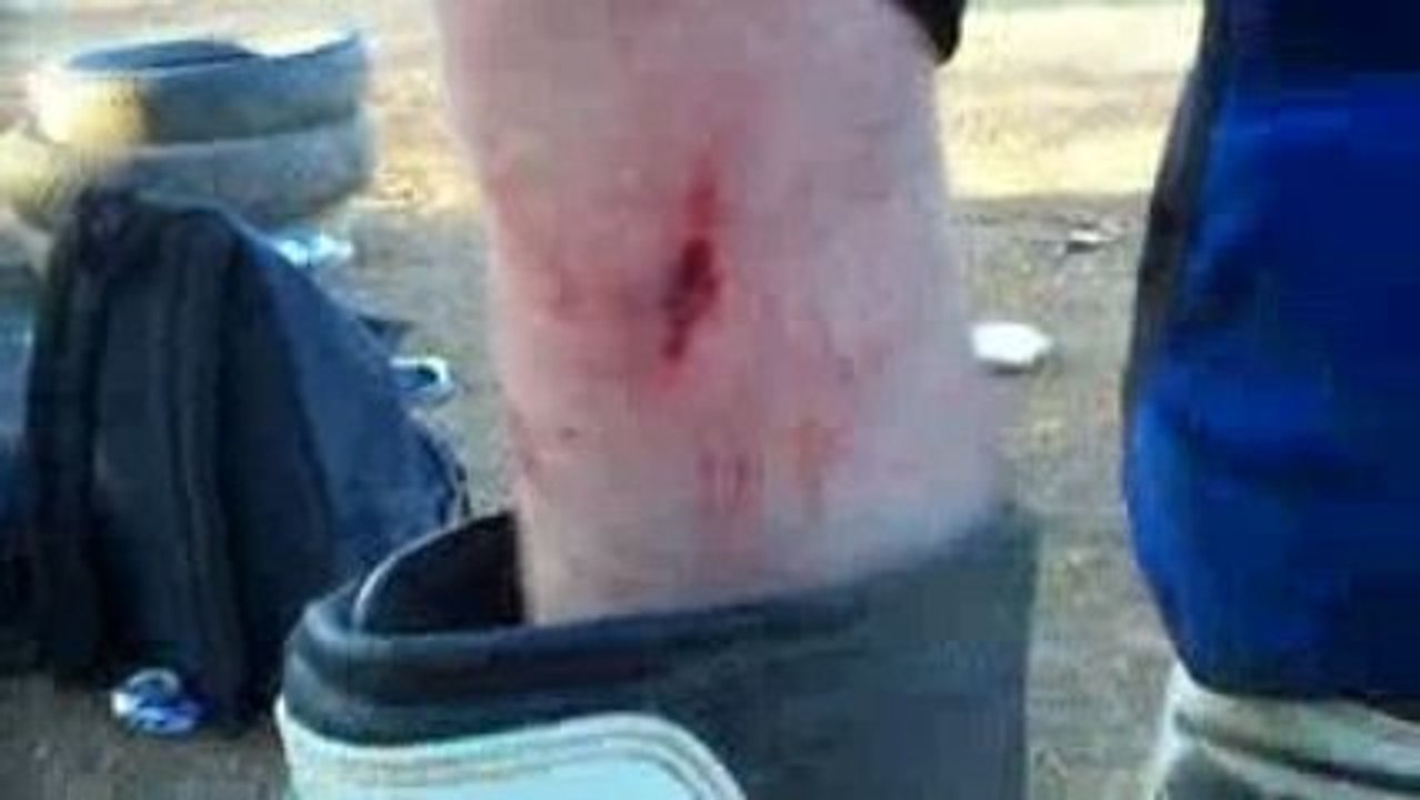 le bobo d'alain sa fait mal. un guidon/tibia