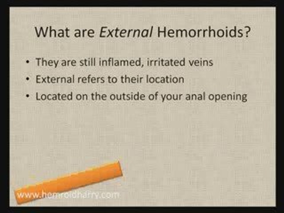Get Rid Of Your External Hemorrhoids