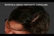 DIRADAMENTO DEI CAPELLI  www.luigiuomo.com