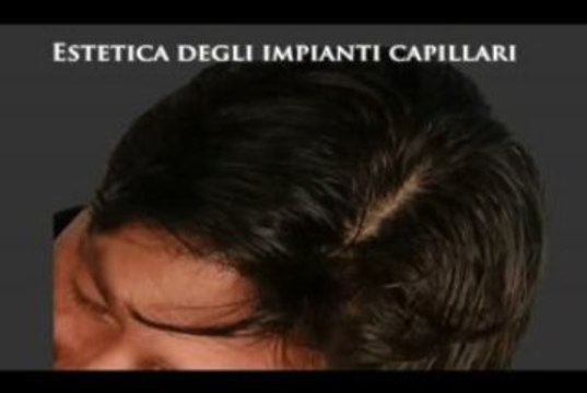 DIRADAMENTO DEI CAPELLI luigiuomo.com
