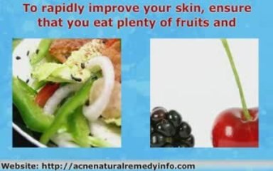 Getting Rid Of Acne By Changing The Way You Eat