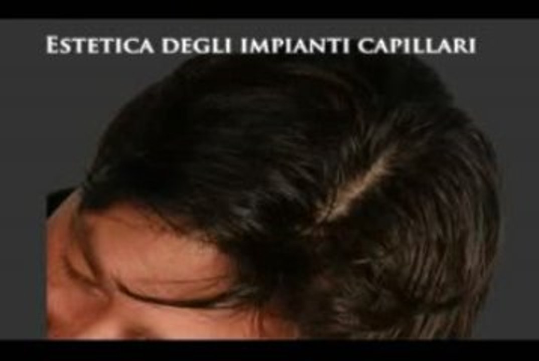 DIRADAMENTO CAPELLI  www.luigiuomo.com