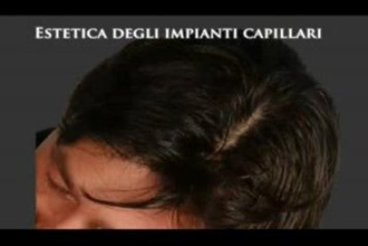 DIRADAMENTO DEI CAPELLI luigiuomo.com