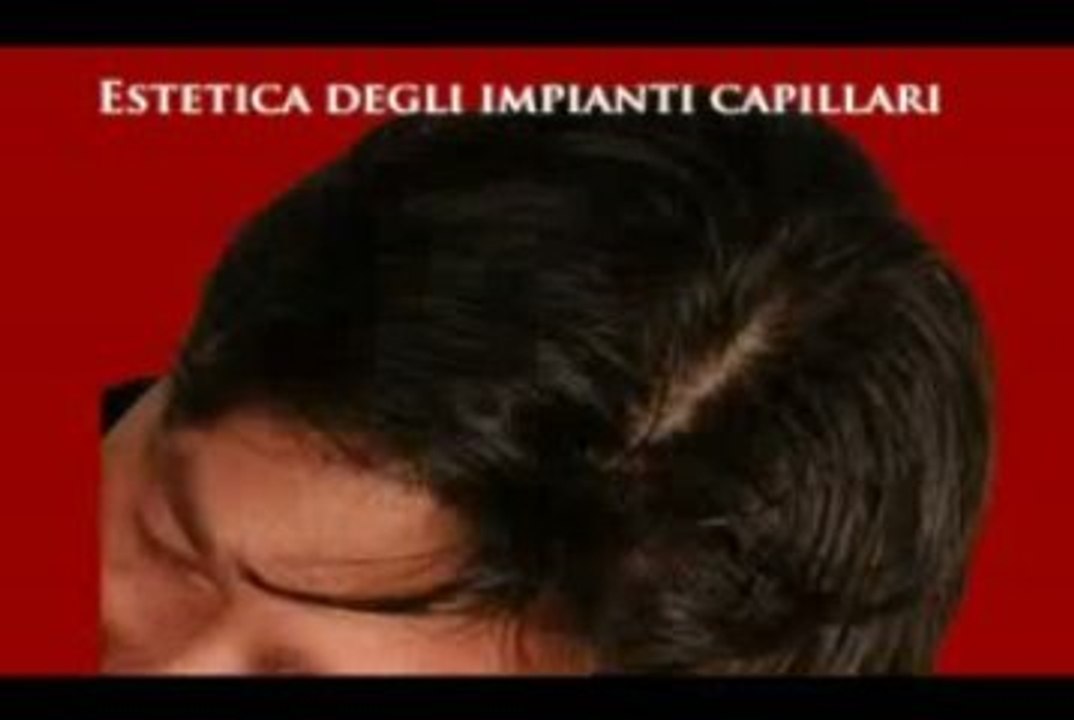 CENTRO INFOLTIMENTO CAPELLI  www.luigiuomo.com