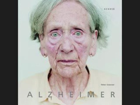 10 Sintomas de la Enfermedad de Alzheimer