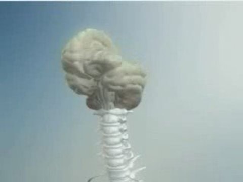 Demencia tipo Alzheimer (Sociedad Española de Neurologia)