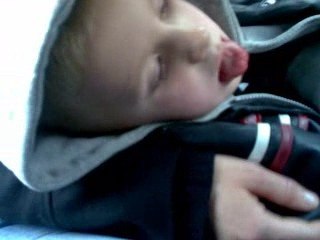 after dentist after anaesthetic:)