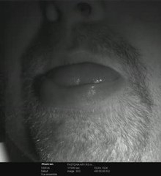 bouche
