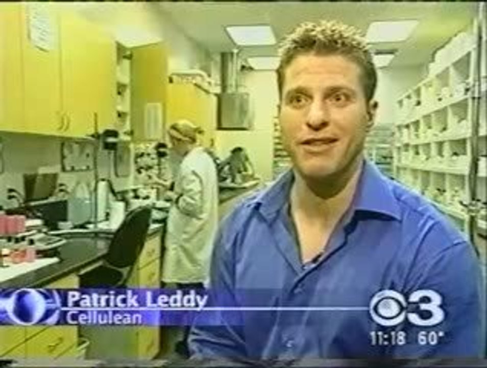 Get Rid of Cellulite Legs