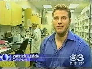 Get Rid of Cellulite Legs