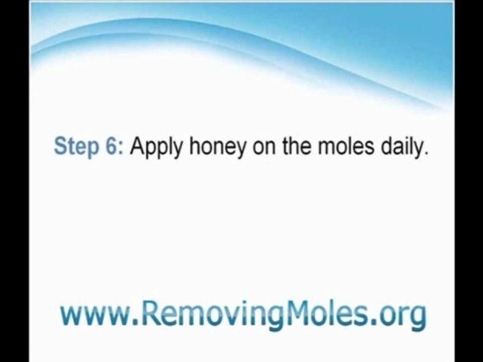 Mole Removal - How  I Did It
