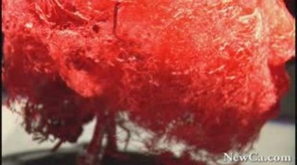 NewCa.com: Body Worlds - Interview with Dr. Angelina Whalley