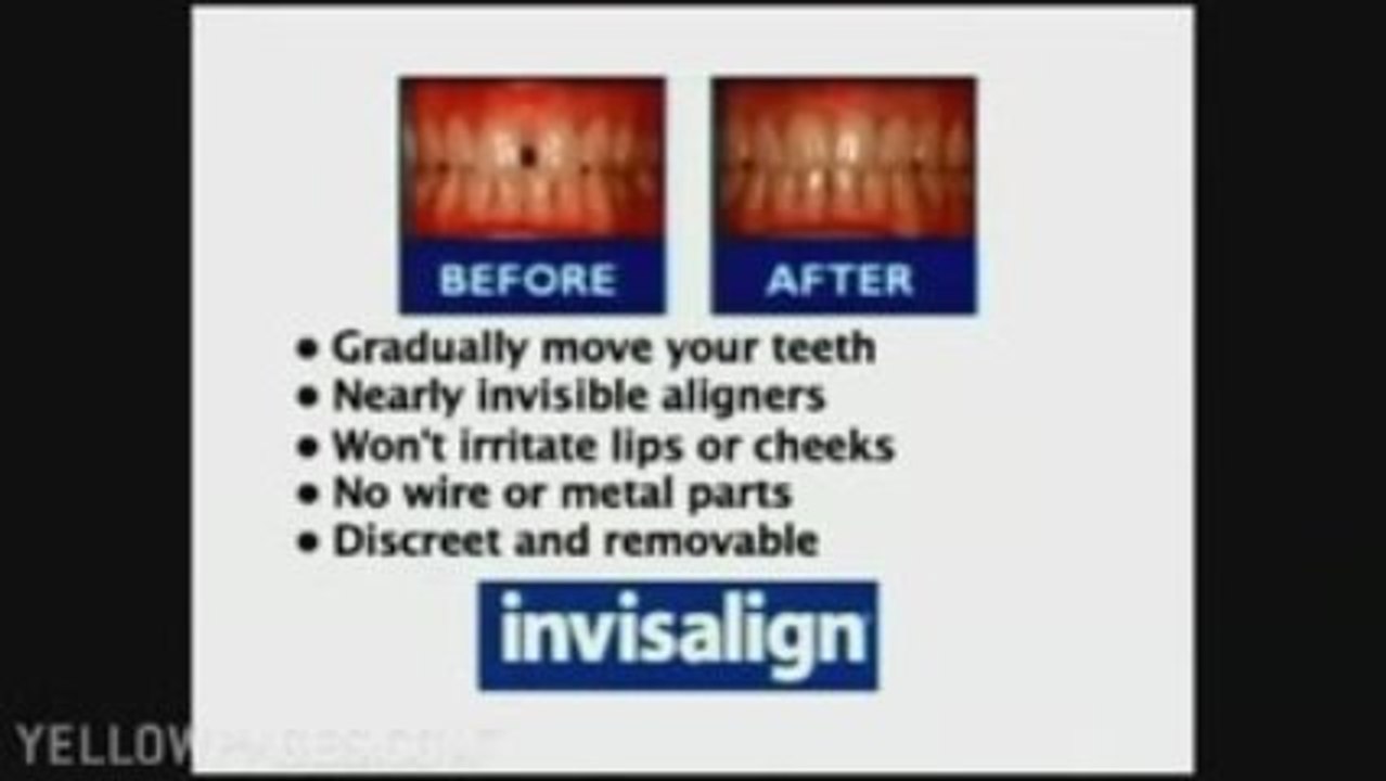 Crowns Peabody Ma 978-535-8244