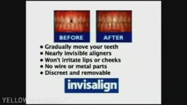 Invisalign Salem Ma 978-535-8244