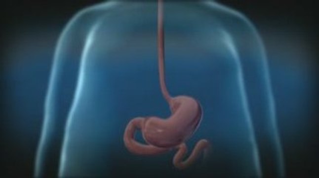 The Strax Rejuvenation Lap-BAND System