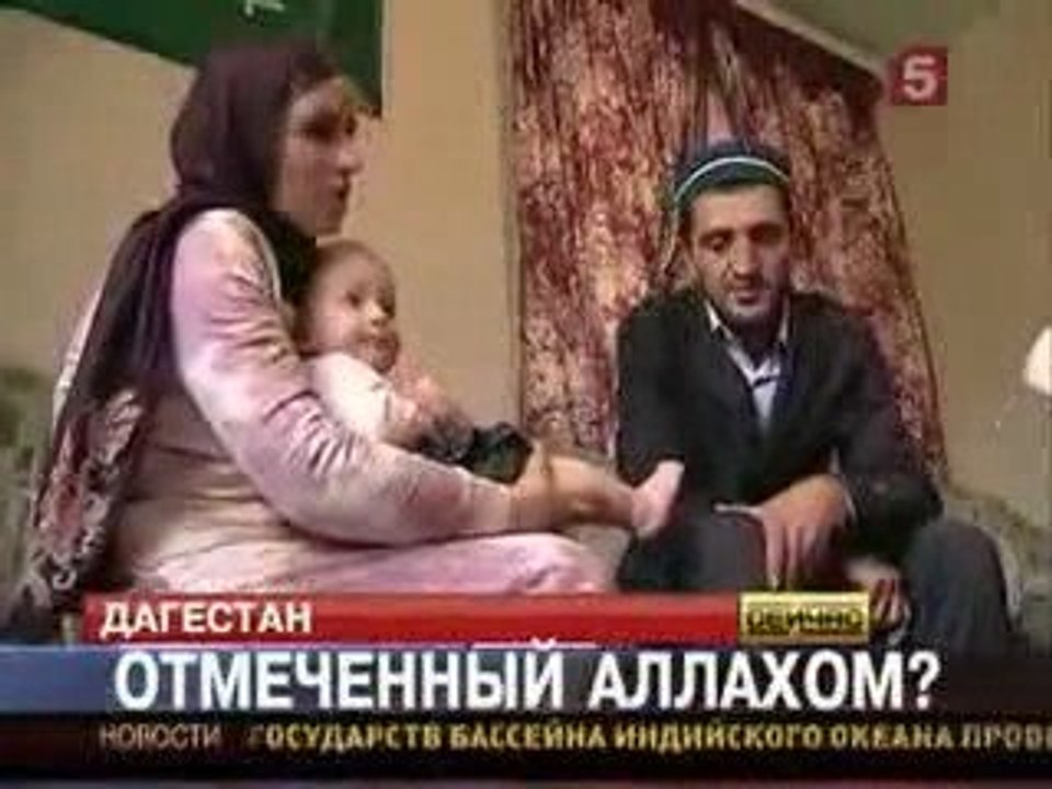 Miracle: Ali Yakubov - Coran et histoire sur la peau d1 bébé