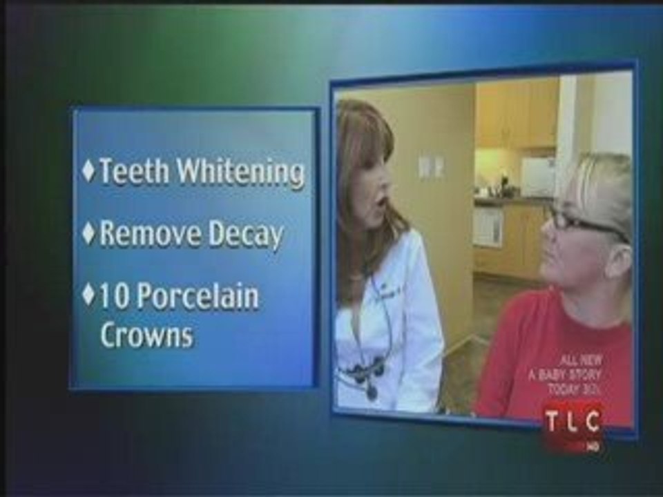 Teeth Whitening Chatsworth-Marilyn Calvo DDS Teeth Whitening